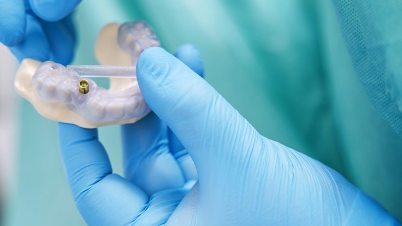 Manos de doctor sujetando implante